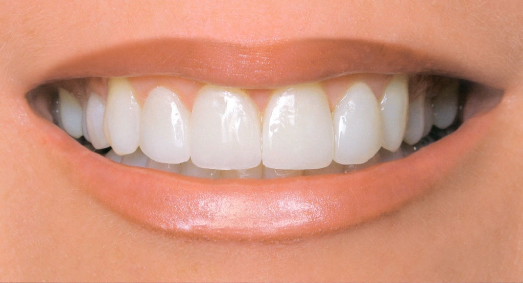 Зубы с пятнами и сколами